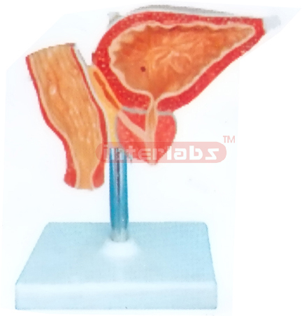 HUMAN GALL BLADDER, PROSTATE AND RECTUM MODEL